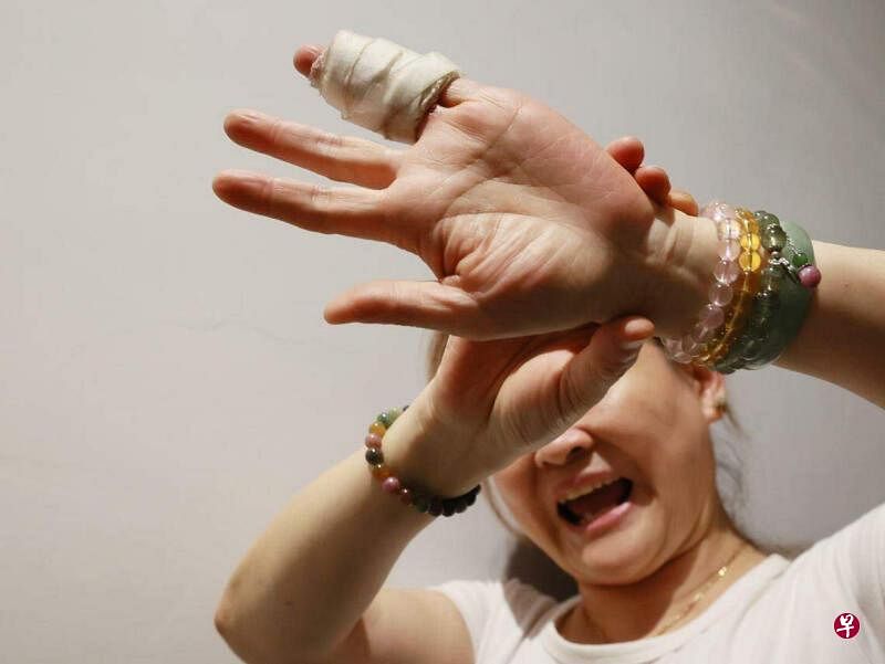 吴女士的手指被夹时十分痛苦，如今仍需吃止痛药。（潘丰源摄）