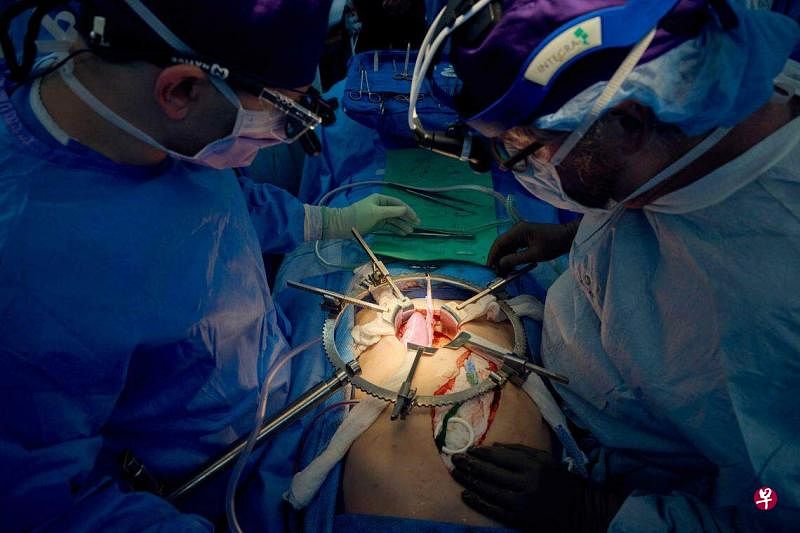 美国医疗团队为一名脑死患者移植基因改造过的猪肾，它在移植人体的32天后仍正常运作。（法新社）