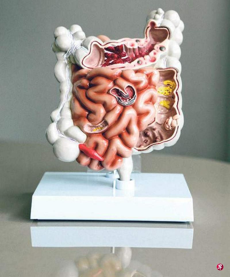 图为肠道模型。（档案照片）